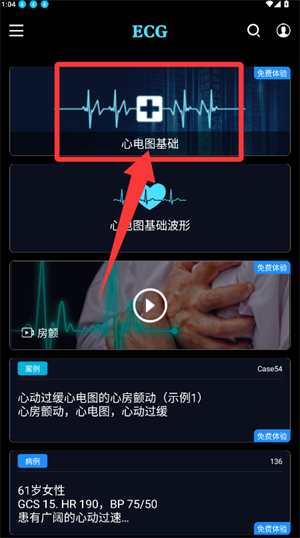 �ĵ�ͼECG(�ĵ�ͼѧϰ����)